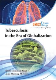 Tuberculosis in the Era of Globalization by Al-Anzai, Khalid