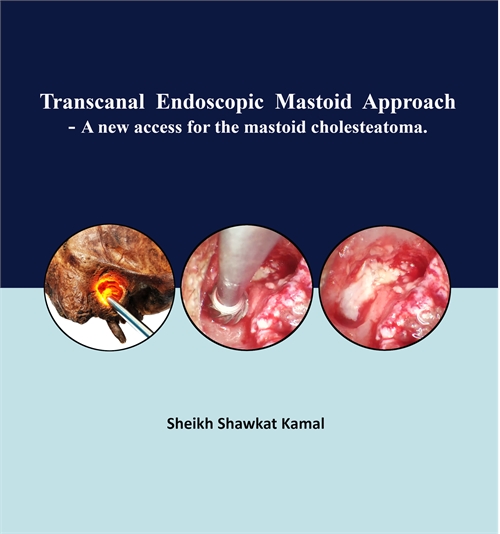 Transcanal Endoscopic Mastoid Approach :... by Kamal, Sheikh , Shawkat